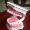 Cheap Study dental care model