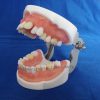 High Quality Dental Tooth Extraction Model