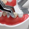 High Quality Dental Tooth Extraction Model