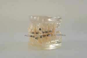 Top Quality Orthodontic Demonstrator Model