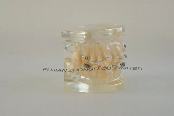 Top Quality Orthodontic Demonstrator Model