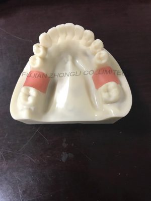 Cheap Resin Dental Implant Model Lowest Price