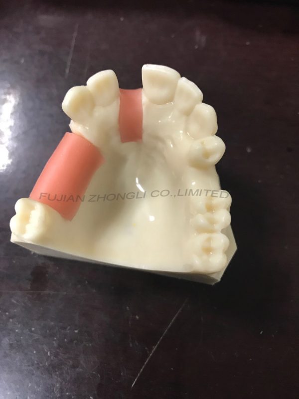 Cheap Resin Dental Implant Model Lowest Price