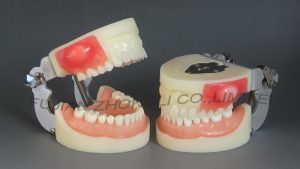 Dental Incision/Pus Removal Typodont