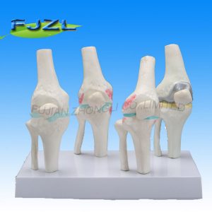 Knee Joints Synthesis Model