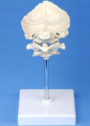 Atlas, Axis and Occipital Bone