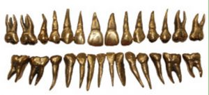 Permanent Teeth Metal Root Resin Crown