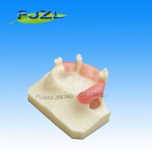 Cheap Resin Sinus Lift for Implant Lowest Price