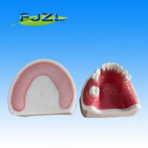 High Quality Dental Implant