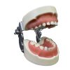 Dental Model with Removable Teeth