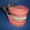 Typdont Teeth Model for Abutment