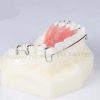 Dental Oral Retainer Demonstration Model