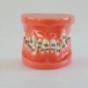 Top Selling Orthodontic Demonstrator Model