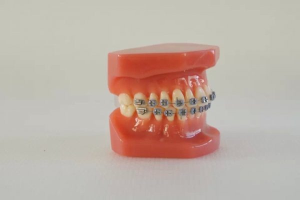 Cheap Orthodontic Demonstrator Model