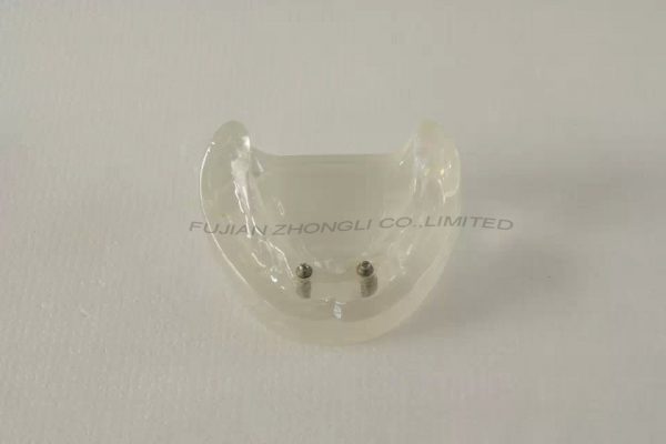 Cheap Dental Implant with 4 Implant and 2 Implant