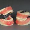 Dental Synthetic Training Typodont for Oral Surgery
