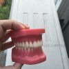 Cheap Dental Teeth for Orthodontic