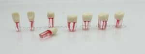 Cheap Endodontic Teeth Root Canal Treatment S12