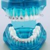 Five-Star Dental Orthodontics Typodont Model