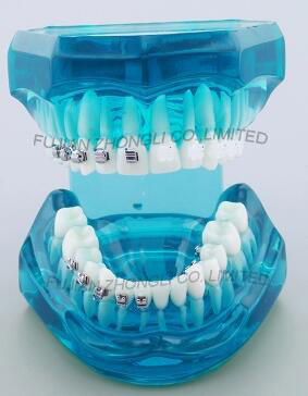 Five-Star Dental Orthodontics Typodont Model