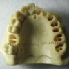 Hot Sell Dental Implant Drilling Practice Model