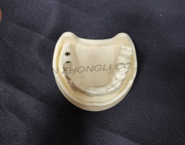 Dental Implant for Practice