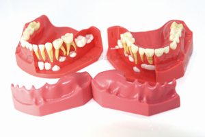 Dentural Development Model