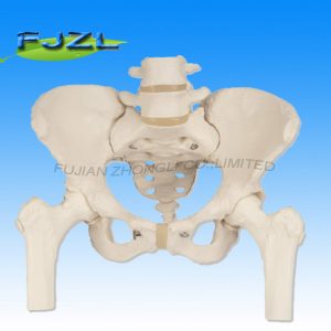 Pelvis with Lumbar Spine and Femoral Head
